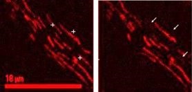 原位细胞3D切割成像平台-CellSurgeon