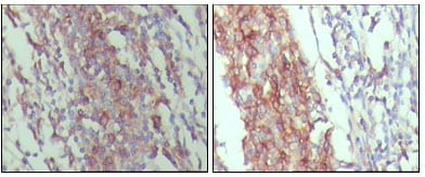 Mouse Monoclonal Antibody to C