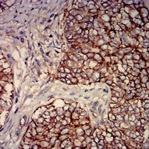 Mouse Monoclonal Antibody to CD46