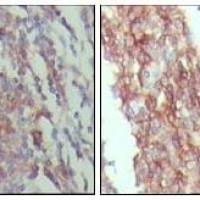 Mouse Monoclonal Antibody to CD45