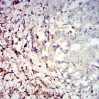 Mouse Monoclonal Antibody to CD39