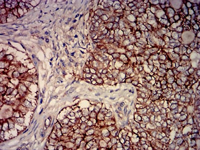 Mouse Monoclonal Antibody to C