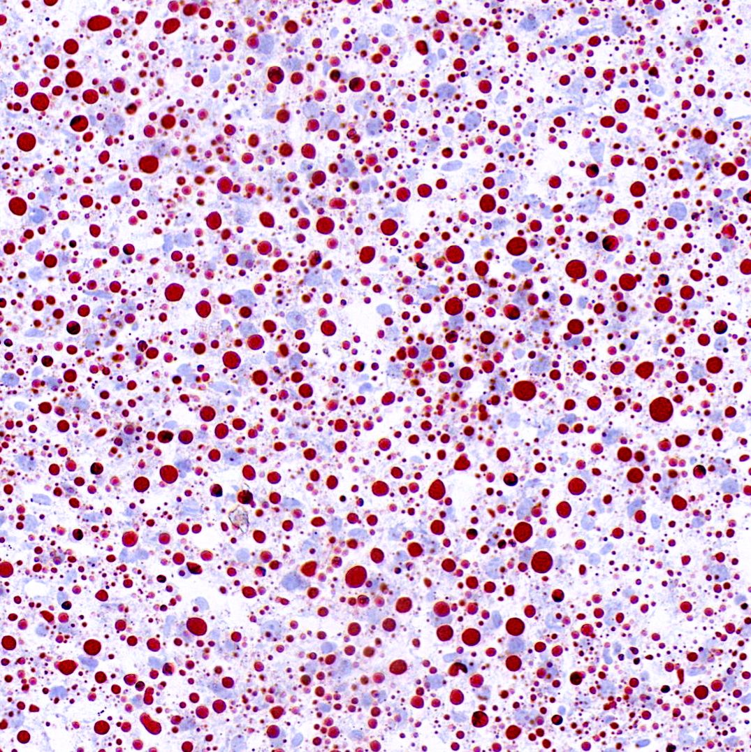 检测实验丨油红O染色实验