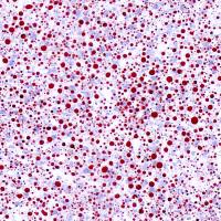 检测实验丨油红O染色实验