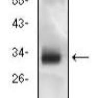 Mouse Monoclonal Antibody to CD74
