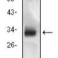 Mouse Monoclonal Antibody to CD74