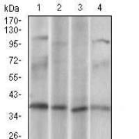 Mouse Monoclonal Antibody to CD68