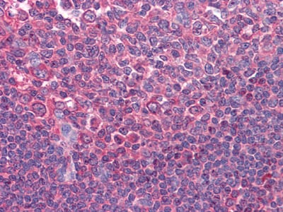Mouse Monoclonal Antibody to C