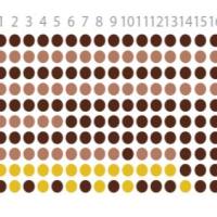 三阴性乳腺癌组织芯片BRC1603