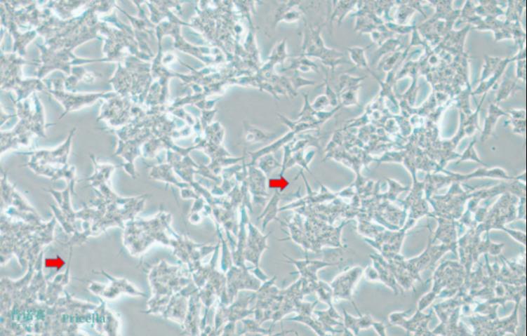 细胞学堂 | 细胞拉丝的五大常见原因及解决方法