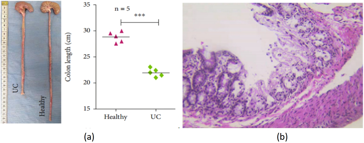 DSS诱导大鼠溃疡性结肠炎模型