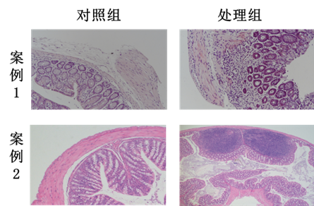 如何评价DSS诱导结肠炎模型是否成功