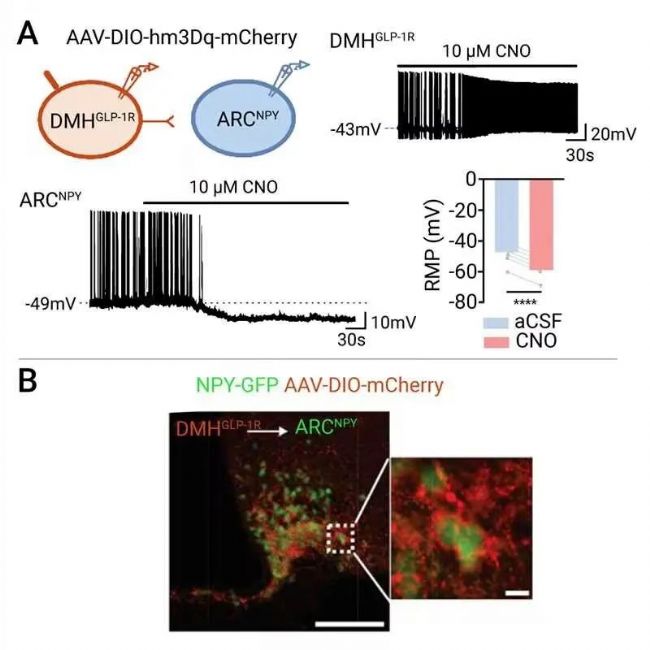 国内获批：司美格鲁肽！市场热捧的 