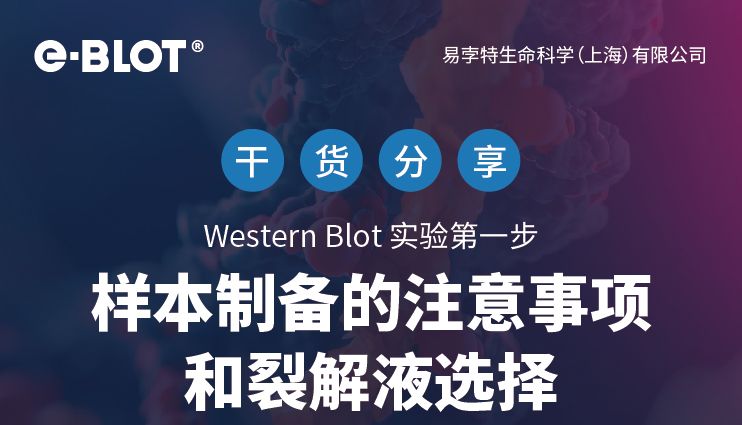 干货分享 | Western Blot 实验第一步 —— 样本制备的注意事项和裂解液选择