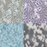 Flavobacterium hibisci