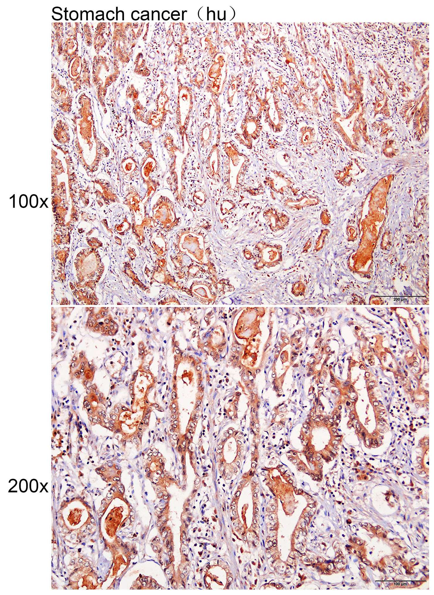 Anti-APOC2 Polyclonal Antibody