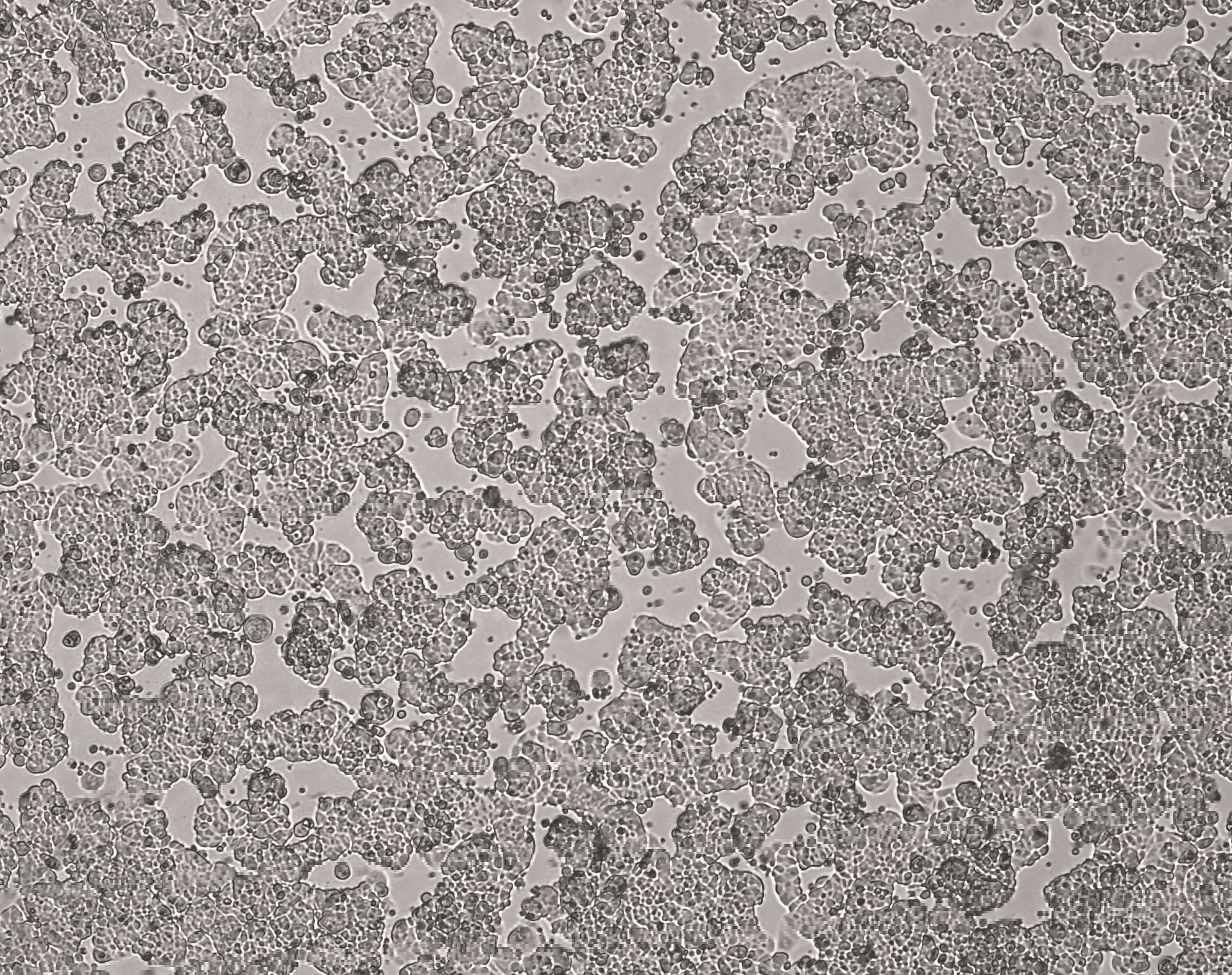 细胞攻略 | MCF-7(人乳腺癌细胞)培养教程