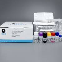 人（Human）丁型肝炎病毒抗原（HDV-Ag） ELISA定性检测试剂盒