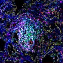 七色多重荧光免疫组化染色试剂盒（鼠兔通用二抗）