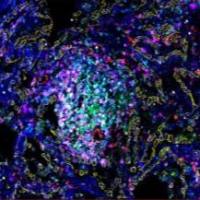 七色多重荧光免疫组化染色试剂盒（鼠兔通用二抗）