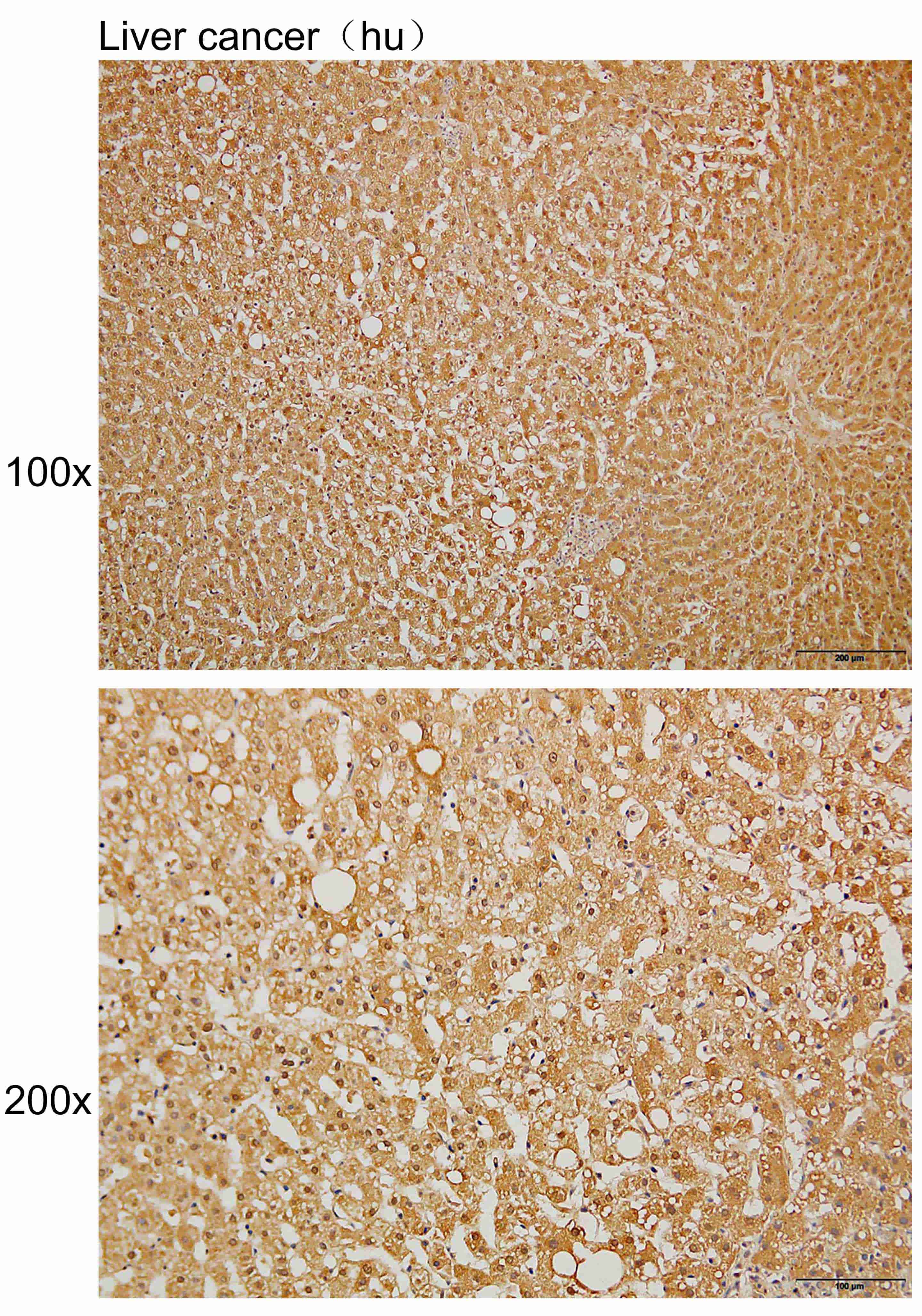 Anti-APOBEC4 Polyclonal Antibo