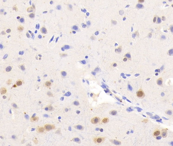 MDA-MB-468人乳腺癌细胞(GFP标记)哪里买