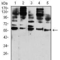 Mouse Monoclonal Antibody to CD209