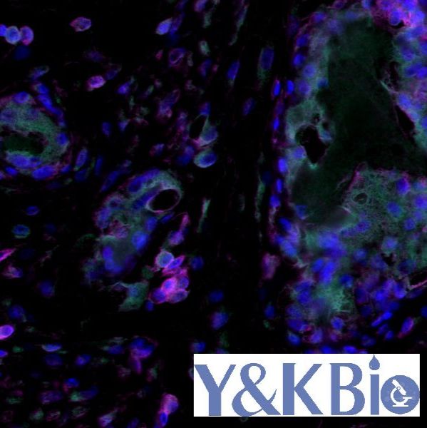 普通切片（同源免疫荧光双标 三色）染色+全景扫描