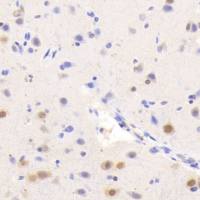 NIC-H1975人肺腺癌细胞（Luc标记）哪里买