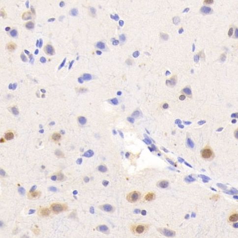 T24人膀胱移行癌细胞(Luc标记)哪里买