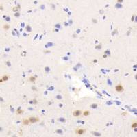 AsPC-1 人转移胰腺腺癌细胞(Luc标记)哪里买