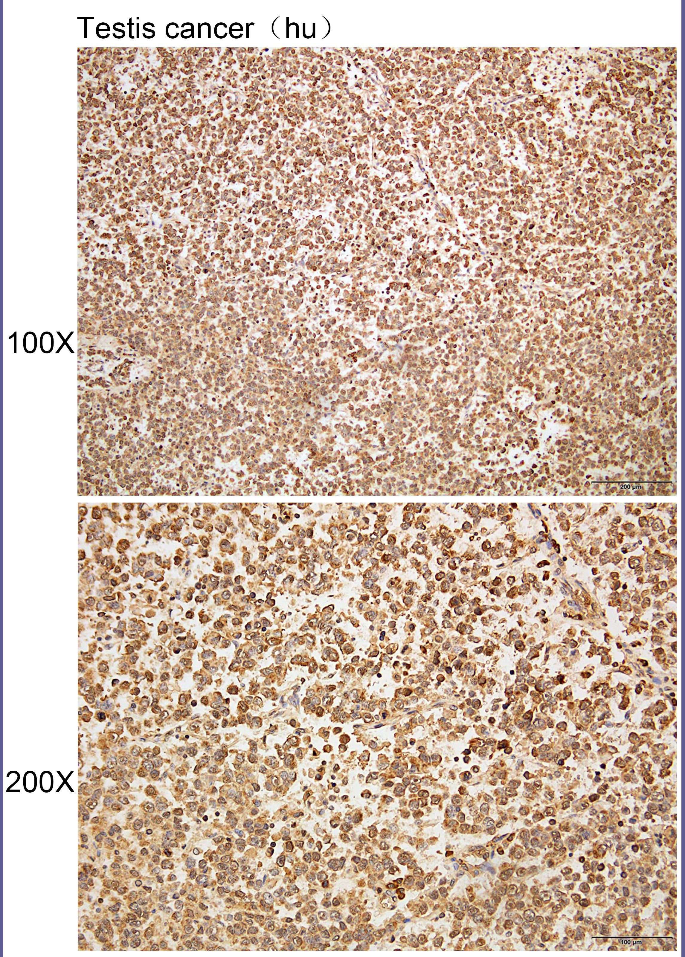 Anti-ARHGAP29 Polyclonal Antib