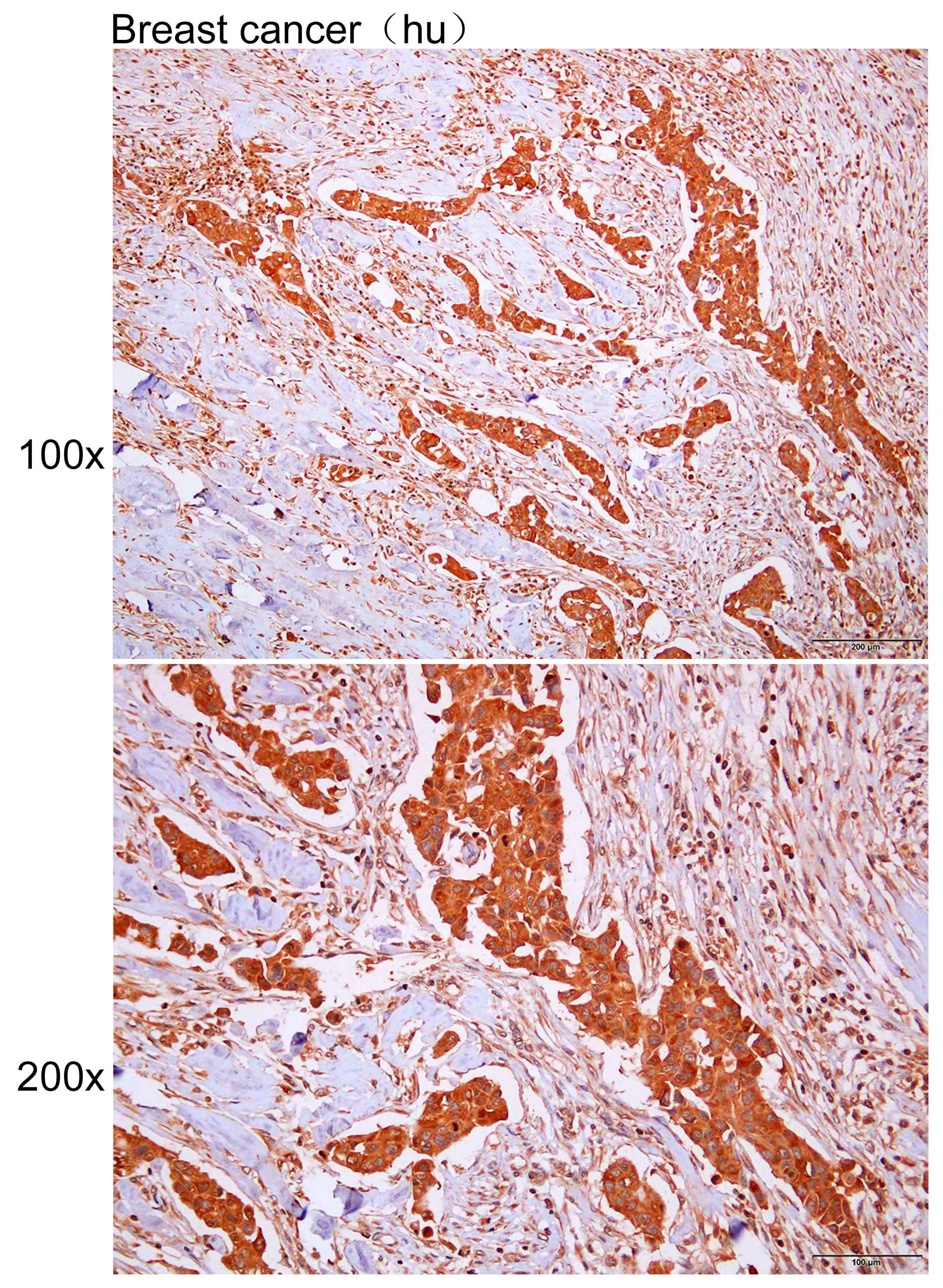 Anti-ARHGDIA Polyclonal Antibo