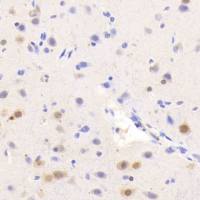 HCT 8人回盲肠癌细胞（Luc标记）哪里买