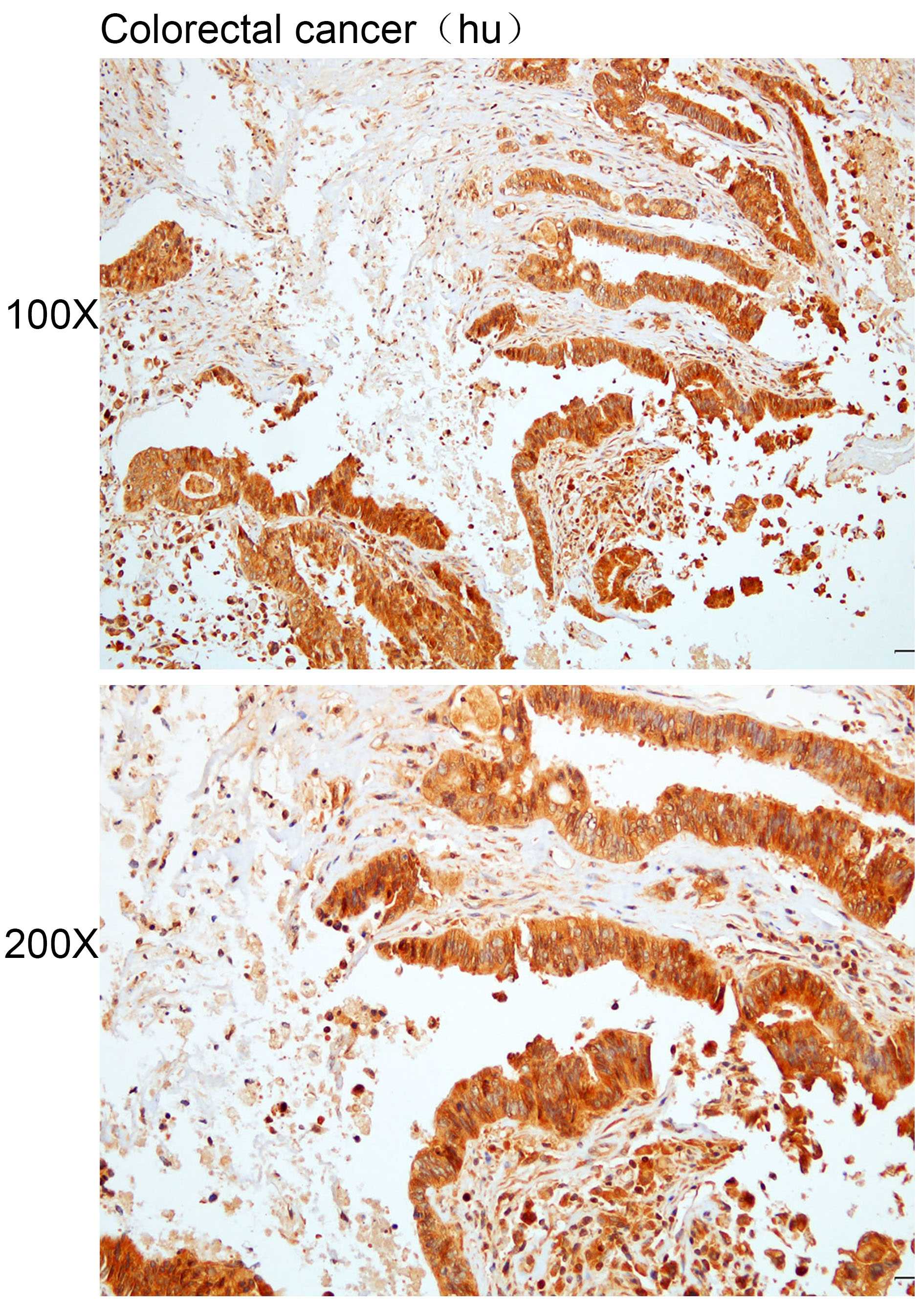 Anti-ARHGAP32 Polyclonal Antib
