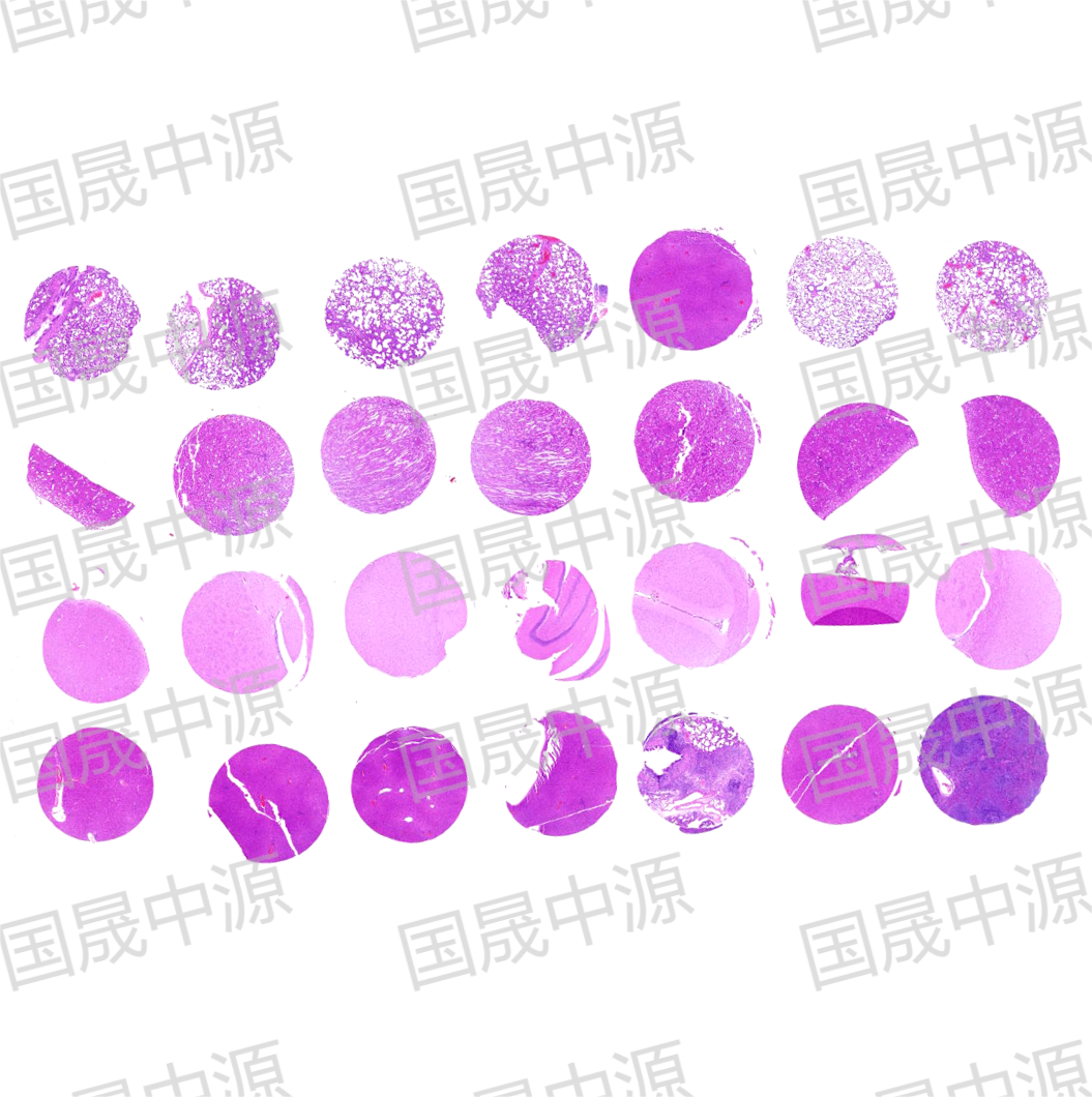 检测实验丨组织芯片HE染色实验步骤及注意事项