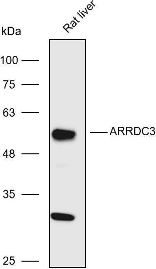 Anti-ARRDC3 Polyclonal Antibod