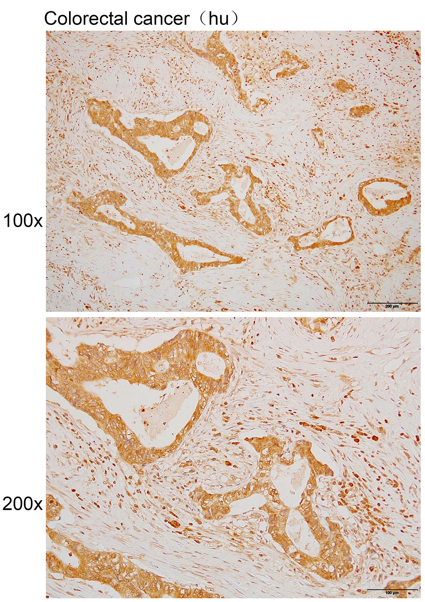 Anti-ATAD4 Polyclonal Antibody