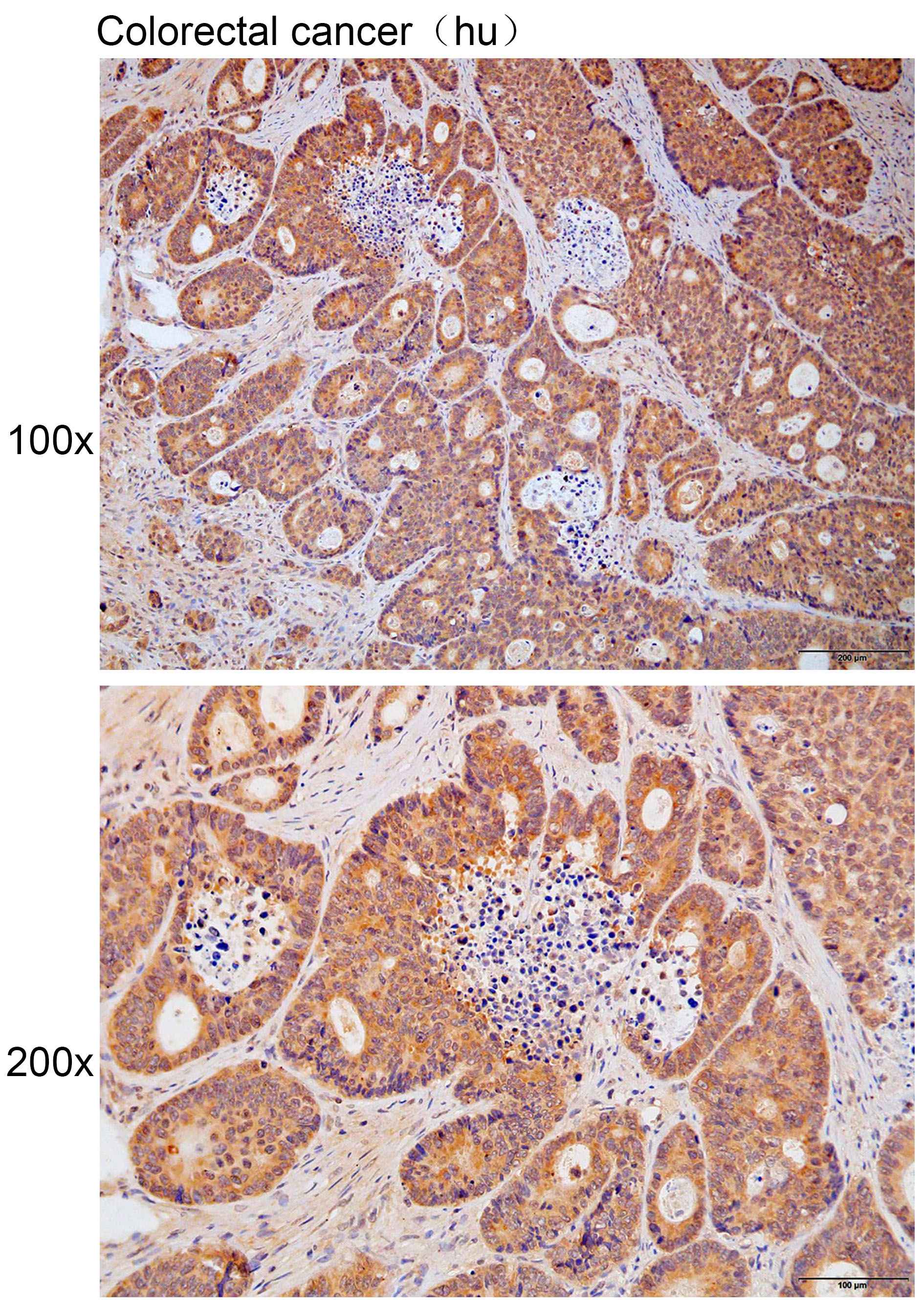 Anti-ARPC1A Polyclonal Antibod