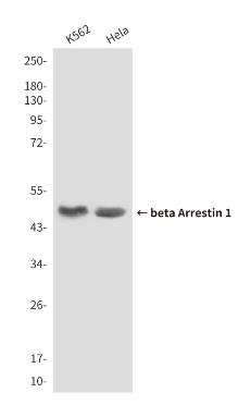 Anti-ARRB1 Monoclonal Antibody