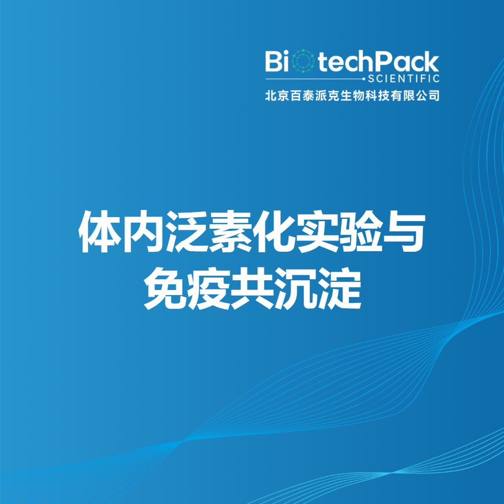 体内泛素化实验与免疫共沉淀