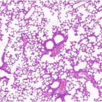 慢性阻塞性肺疾病(COPD)小鼠模型