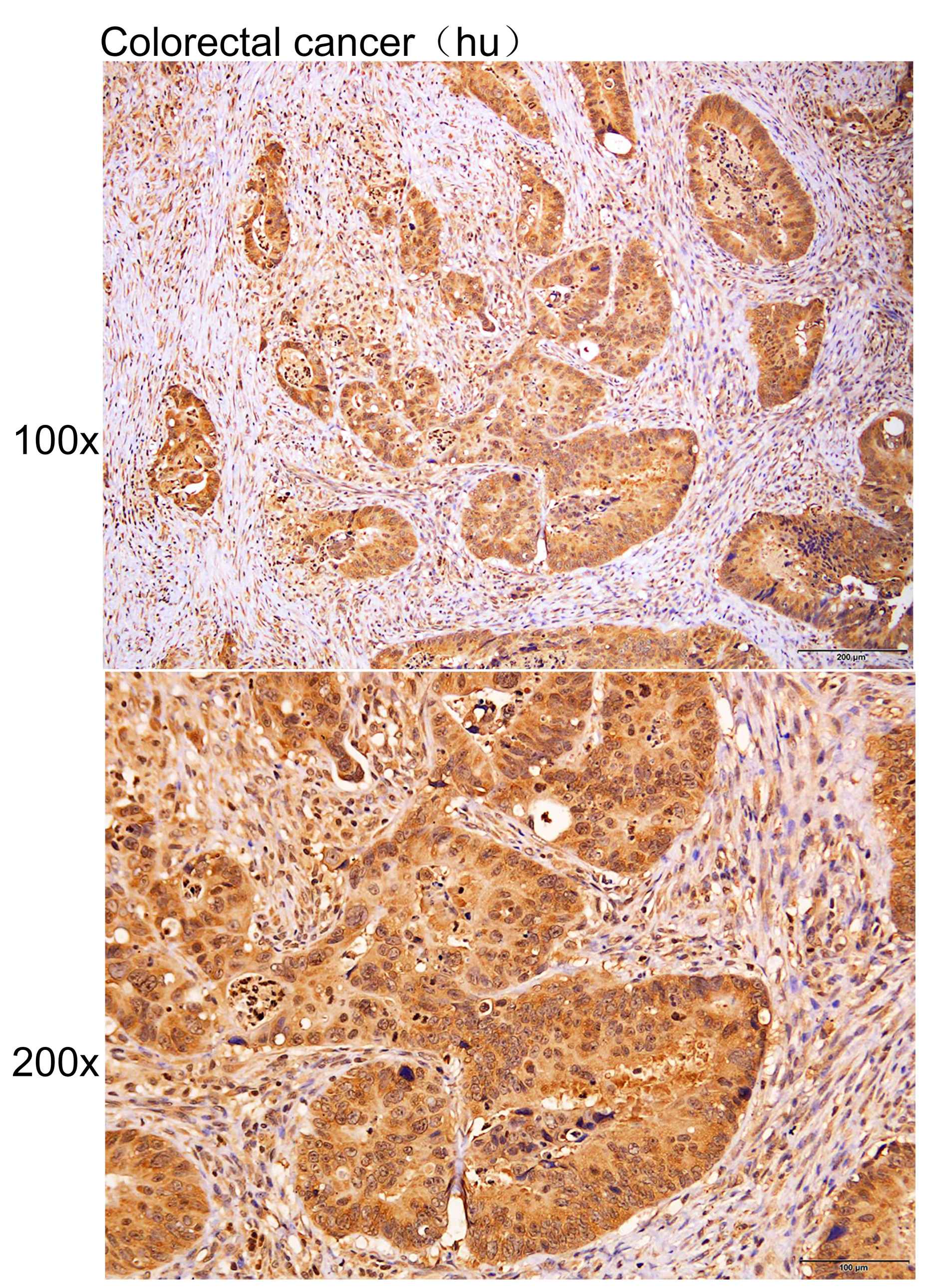 Anti-ATPAF2 Polyclonal Antibod