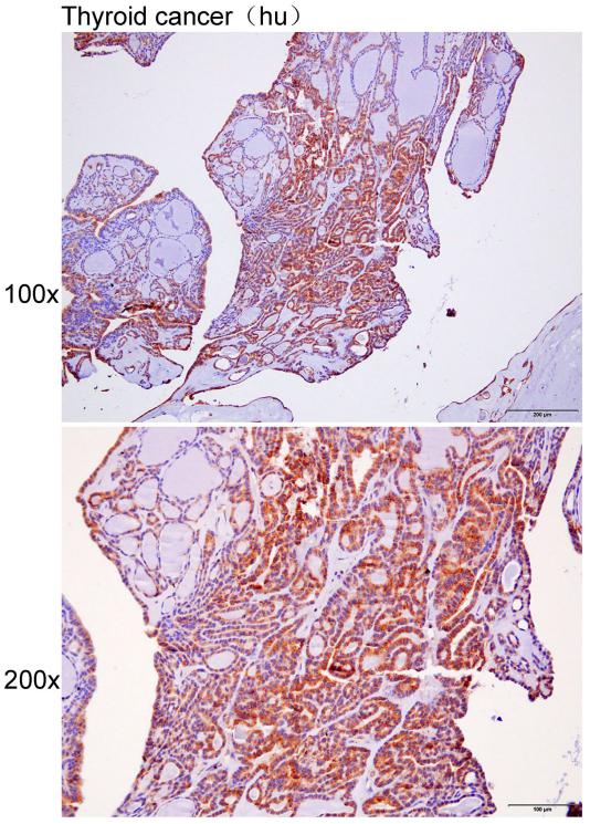 Anti-ATG9A Polyclonal Antibody