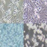 Altererythrobacter fulvus