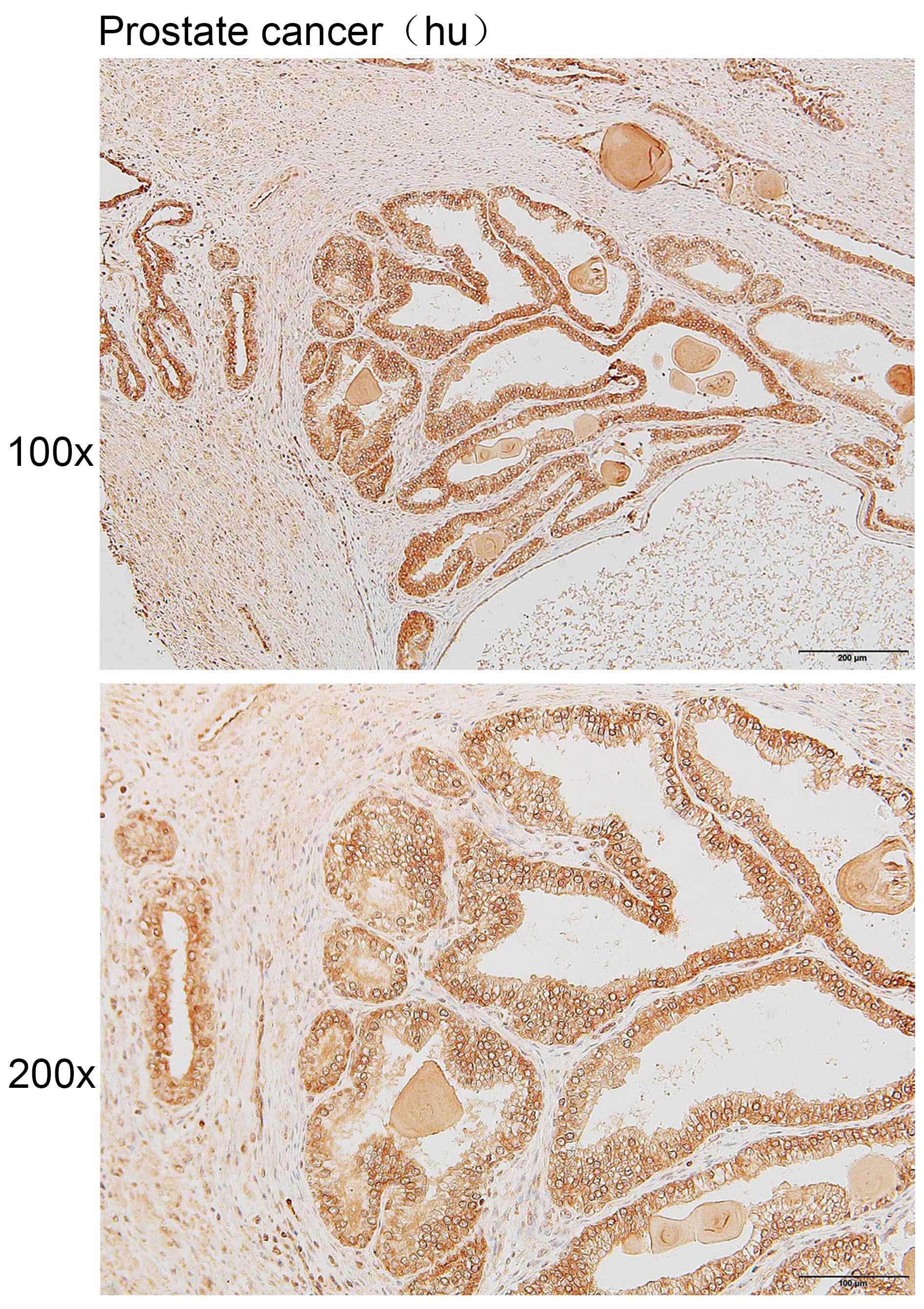 Anti-ATP2A1 Polyclonal Antibod