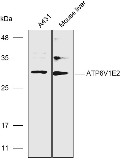 Anti-ATP6V1E2 Polyclonal Antib