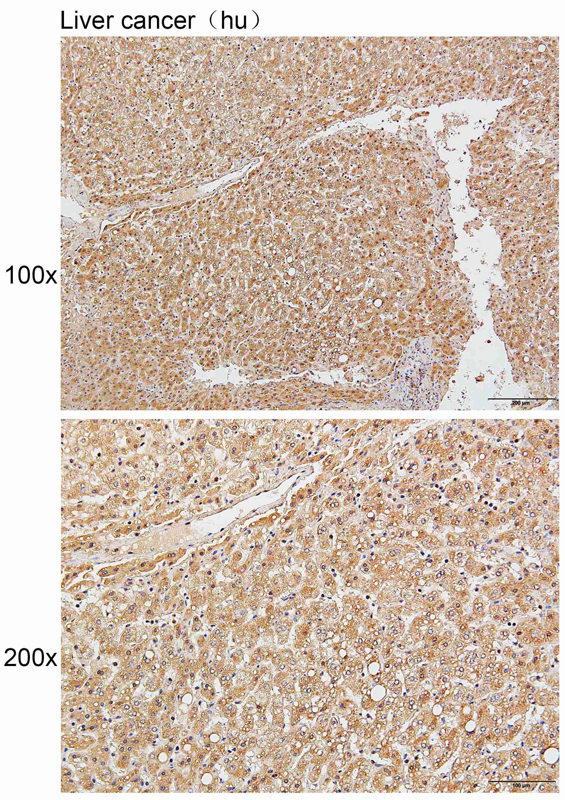 Anti-AurB/C Polyclonal Antibod