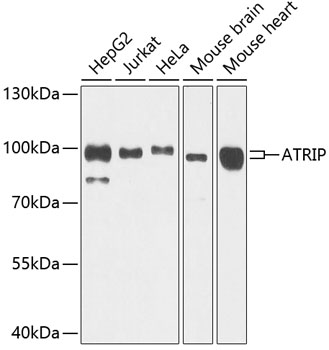 Anti-ATRIP Polyclonal Antibody