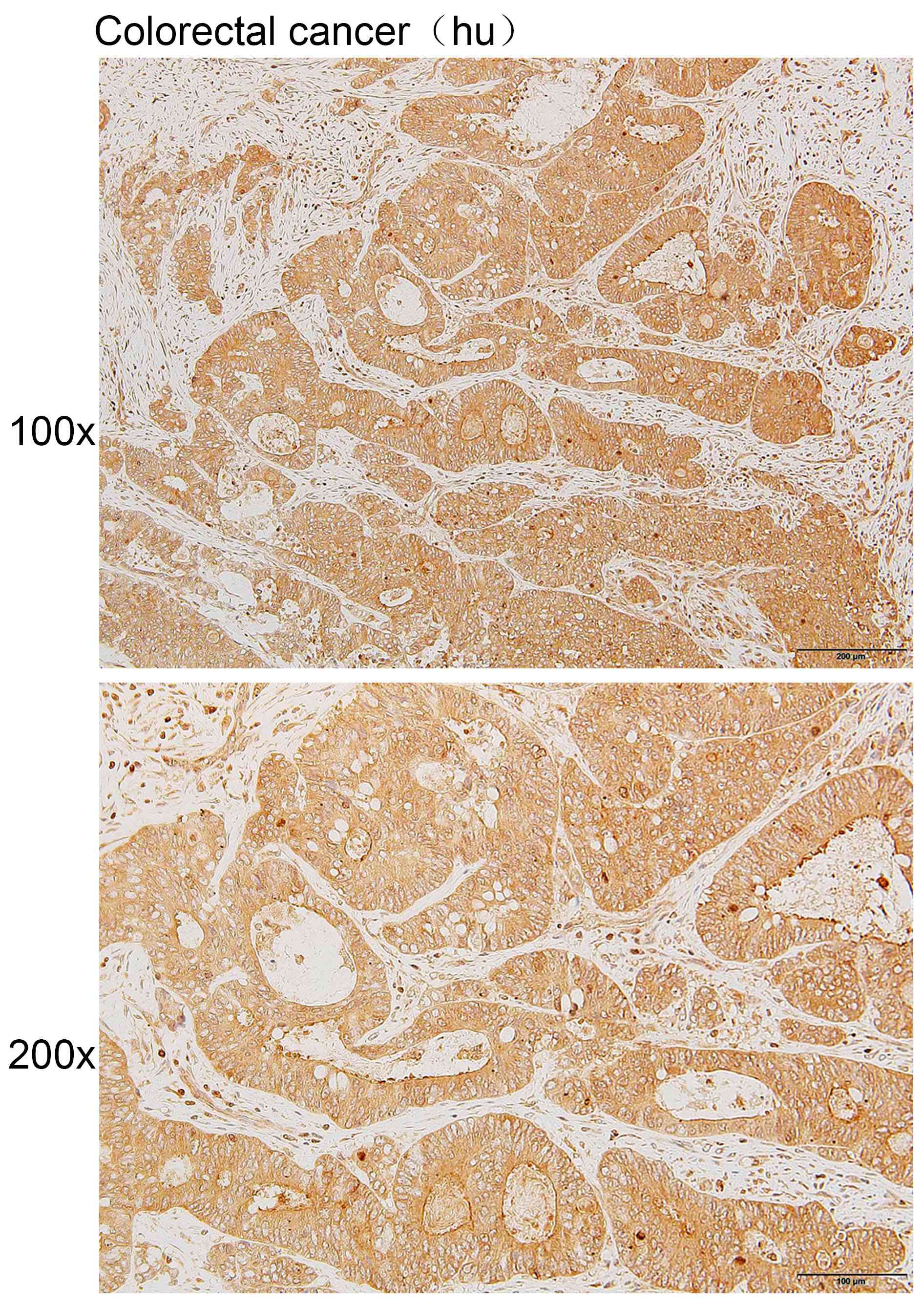 Anti-ATP6V0A2 Polyclonal Antib